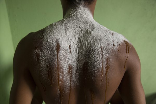 Espinha – Image 5